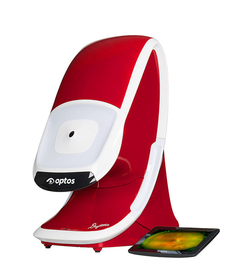 英國全景激光掃描眼底照相